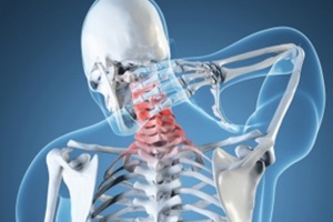 A fő tünetek a nyaki degeneratív betegség lemez