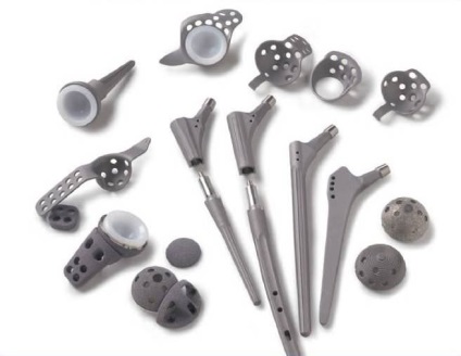 Jellemzők Revision arthroplasty evőkanál (csípőprotézis) Jellemzők Revision arthroplasty evőkanál