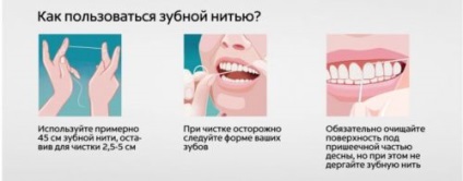 A periodontális betegség oka a felnőttek öröklődés, fertőzés (parodontitis) A periodontális betegség oka a felnőttek öröklődés, a fertőzés