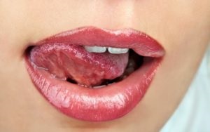 szájszag a nyelv fehér virágzású
