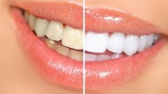 Miért van az édes fogfájás - ha a fogak reagálnak az édes - Egészség és Orvostudomány - mindkettő