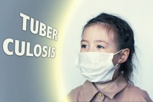 Tuberkulózis megelőzésére gyermekeknél