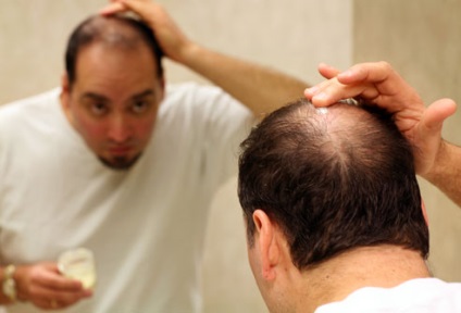 Seborrhea hajhullás, hasznosítás kezelés után, ajánlások