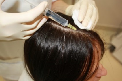 Seborrhea hajhullás, hasznosítás kezelés után, ajánlások