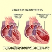 Szívelégtelenség kezelésére használt gyógyszerek - a szív-