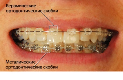 A különbség a fogak, EUROLAB, fogászat