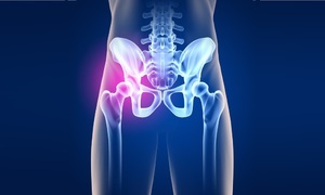 Modern kezelési módszerek a csípő osteoarthritis