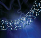 A koszorúér-stent beültetést - Magyar Kardiológiai Tudományos Termelési kopmleks (ma) A koszorúér-stent beültetést - Magyar Kardiológiai Tudományos Termelési kopmleks