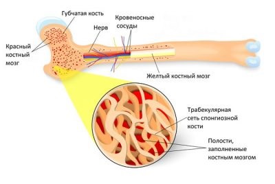 Трабекулярной набряк кісткового мозку що це таке, і як лікувати