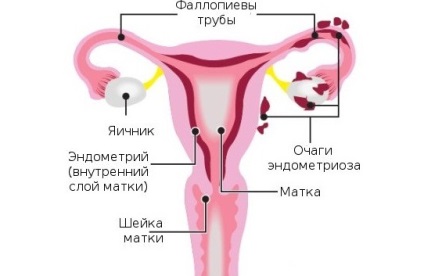 Gyógynövények erős menstruáció melyek gátolják vérzés vagy csökkentse azt az erős,