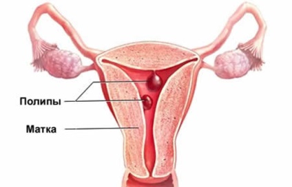 Gyógynövények erős menstruáció melyek gátolják vérzés vagy csökkentse azt az erős,