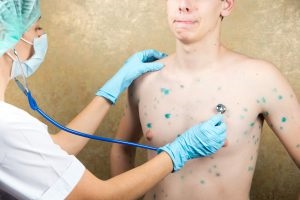 Bárányhimlő lehet összetéveszteni semmivel, hogyan kell kezelni (mix) Bárányhimlő lehet összetéveszteni semmivel, hogyan kell kezelni