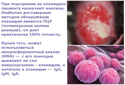 Хламідіоз - фото, як виглядають ознаки захворювання