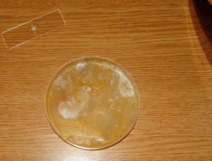 Jaroszláv, 10 év (mikroszkóp) Jaroszláv, 10 éves