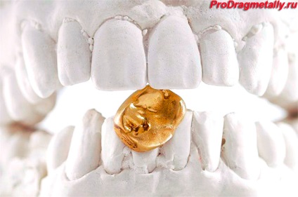 Fogászati ​​arany (fogászati), az ár grammonként, aranykoronát minta