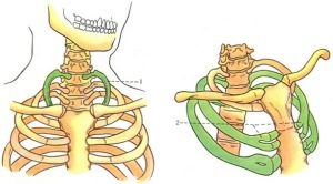 Mi a nyaki borda okoz, tünetei és kezelése az emberi betegségek