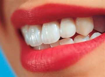 Kozmetikai fogpótlás - restaurálási technikák elülső és hátulsó fogak, a költségek