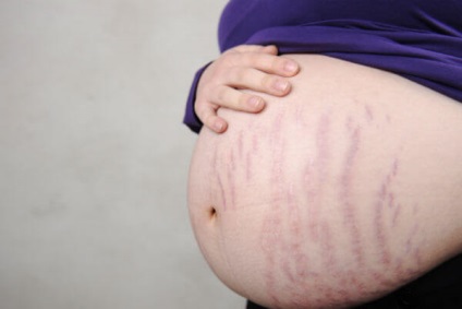 terhesség és cukorbetegség kezelés népi jogorvoslati