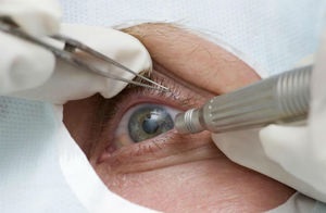Subconjunctivális adagolásra gyógyszerek kezelésére szemészeti betegségek