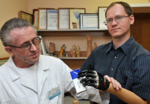 A perm elsajátította bioelectrical váll protézis