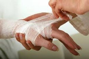 1, 2, 3 és 4, a mértéke égési, a jelek és tünetek (égő) 1, 2, 3 és 4, a mértéke égési, a jelek és tünetek
