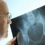 Adenoma a nyálmirigy tünetek, okok és a kezelés (adenoma) Adenoma a nyálmirigy tünetek, okok és a kezelés