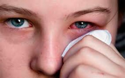 Allergia gesztenye tünetei, diagnózisa, kezelése