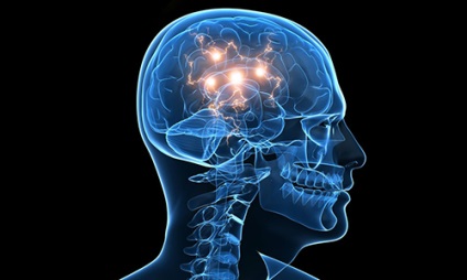 Arachnoid ciszták fossa posterior okok, tünetek, kezelés (hátsó) Arachnoid ciszták a hátulsó cranialis fossa okok, tünetek, kezelés