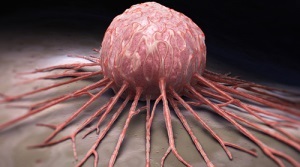 Atheroma a gyermek a fej, az arc vagy a mellkas és fotó tippeket Komarovsky (atheroma a mellkason a gyermek) Atheroma a gyermek a fej, az arc vagy a mellkas, és fotó tippek Komarovka