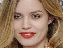 Invisalign zárójelek (US) - hatékony és látható mások (zárójelek) Invisalign zárójelek (US) - hatékony és látható mások