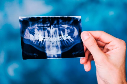 Központi fogászati mia Magyarország (klinika) Központi Dental Clinic Belügyminisztérium Magyarország