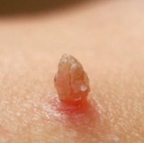Mi a takarmány éjszaka, amikor a baba felébred gyakran enni (felébred) Mi a takarmány éjszaka, amikor a baba felébred gyakran enni