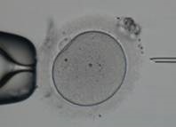 In vitro megtermékenyítés (IVF)