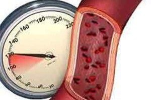 Gipertonium igazi utazó véleménye, összetételét és a használati utasítást a magas vérnyomás
