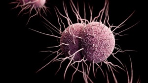 Gonorrhea (triperok) a férfiak - tünetek és a kezelés, mint amilyennek látszik a képen (tünetek) Gonorrhea (triperok) a férfiak - tünetek és a kezelés, mint amilyennek látszik a fotón
