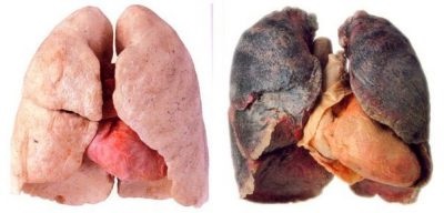 Hogyan tisztítsa meg a tüdőben a dohányzás után, hogyan kell visszaállítani nikotin otthon után egy cigarettát