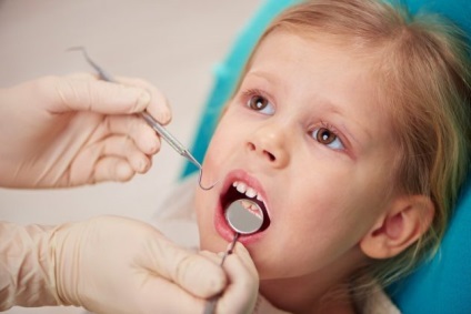 A fogszuvasodás gyermekeknél okoz, tünetei, kezelése és megelőzése