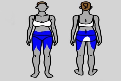 Térkép: hogyan kell érteni a fájdalmat, ami igazán fáj (fájdalom) Térkép: hogyan kell érteni a fájdalmat, ami igazán fáj