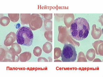 emberi vér sejteket mikroszkóp alatt nevezik őket, és mit (mikroszkóp) emberi vér sejteket mikroszkóp alatt nevezik őket, és mit csinálnak