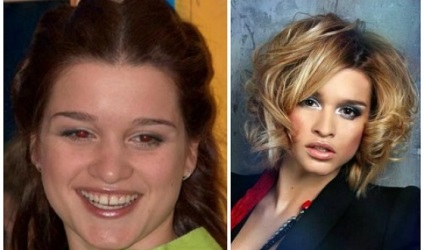 Ksenia Borodina előtt és után plasztikai sebészet fotók és videó