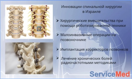 Gerincferdülés kezelés Izrael Árak, visszajelzések, ár