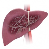 Mesenterialis thrombosis, bél vascularis okok, tünetek, kezelés