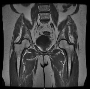 MRI a kismedencei szervek a nők, ami azt mutatja, az MRI-nőgyógyászati, amely esetben ezt MRI (nők) MRI a kismedencei szervek a nők, ami azt mutatja, az MRI-nőgyógyászati, amely esetben ezt az MRI