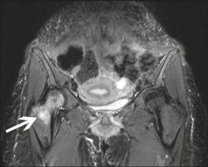 MRI a kismedencei szervek a nők, ami azt mutatja, az MRI-nőgyógyászati, amely esetben ezt az MRI (szervezetek) MRI a kismedencei szervek a nők, ami azt mutatja, az MRI-nőgyógyászati, amely esetben ezt az MRI