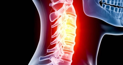 A bizonytalanság a nyaki gerinc gyermekeknél a tünetek, kezelések