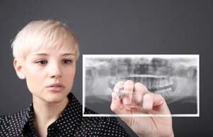 Fogszabályozás - harapás korrekciója felnőttek és gyermekek számára - a korrekció malocclusion és zárójelek (korrekció) Fogszabályozás - harapás korrekciója felnőttek és gyermekek számára - a korrekció malocclusion és fogszabályozó