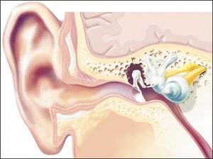 Jellemzők A kezelés kohleonevrita okok és a tünetek, diagnózis a szindróma, kezelésére cochlearis