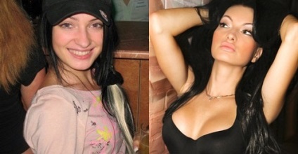 A plasztikai sebészet Eugenia Feofilaktova csillag előtt és után plasztikai