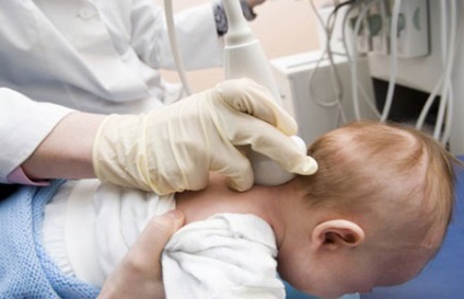 Subluxatio a nyakcsigolya egy gyermeket, hogy a tünetek, kezelés