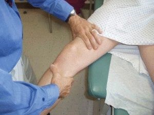 A poszttraumás arthritis tünetek és a kezelés